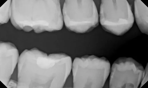course thumbnail